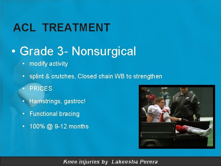 ACL TREATMENT • Grade 3 - Nonsurgical • modify activity • splint & crutches,