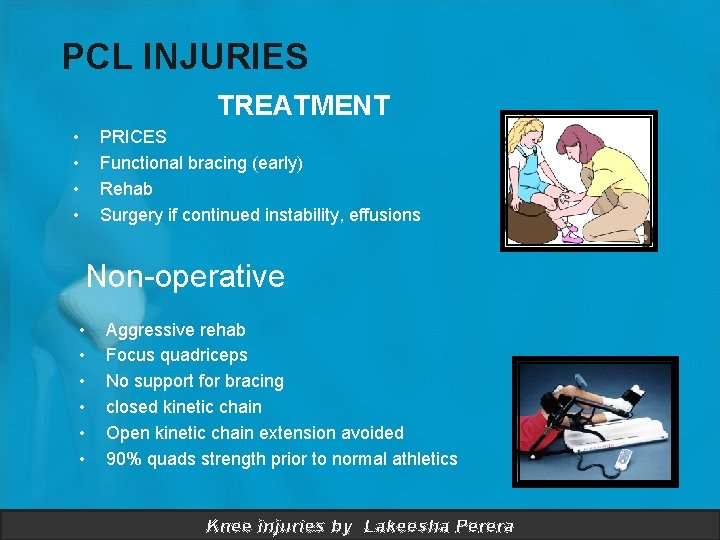 PCL INJURIES TREATMENT • • PRICES Functional bracing (early) Rehab Surgery if continued instability,