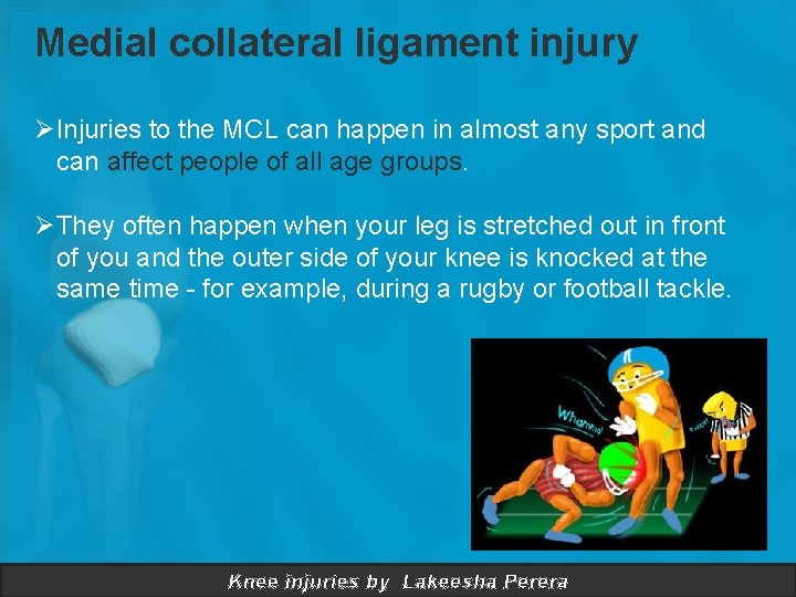 Medial collateral ligament injury ØInjuries to the MCL can happen in almost any sport