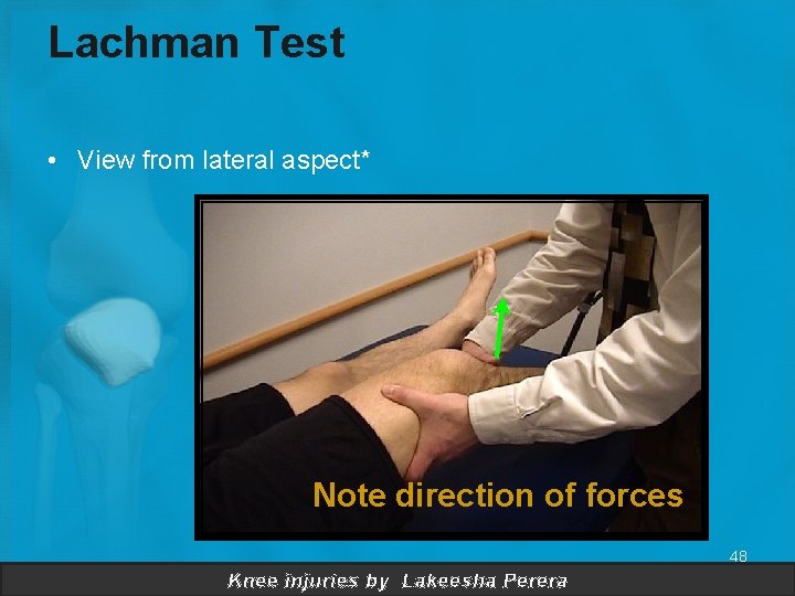 Lachman Test • View from lateral aspect* Note direction of forces 48 Knee injuries