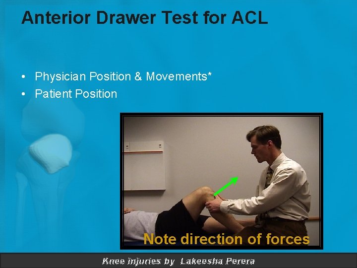 Anterior Drawer Test for ACL • Physician Position & Movements* • Patient Position Note