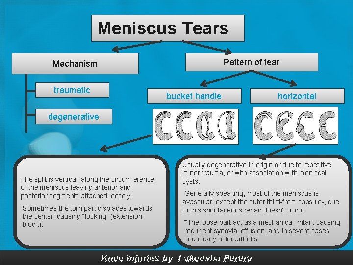 Meniscus Tears Pattern of tear Mechanism traumatic bucket handle horizontal degenerative The split is