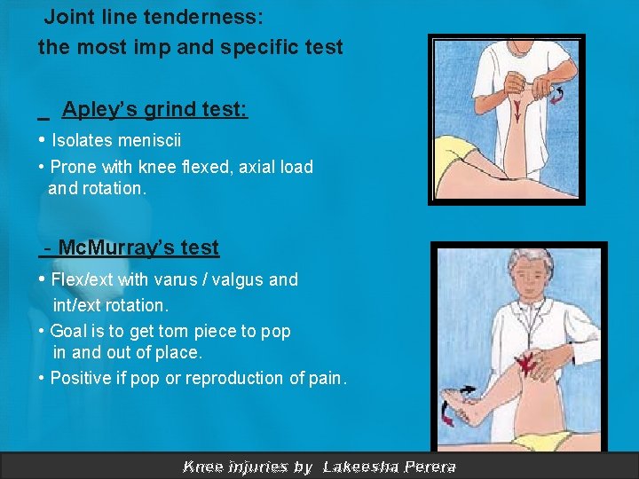 Joint line tenderness: the most imp and specific test _ Apley’s grind test: •