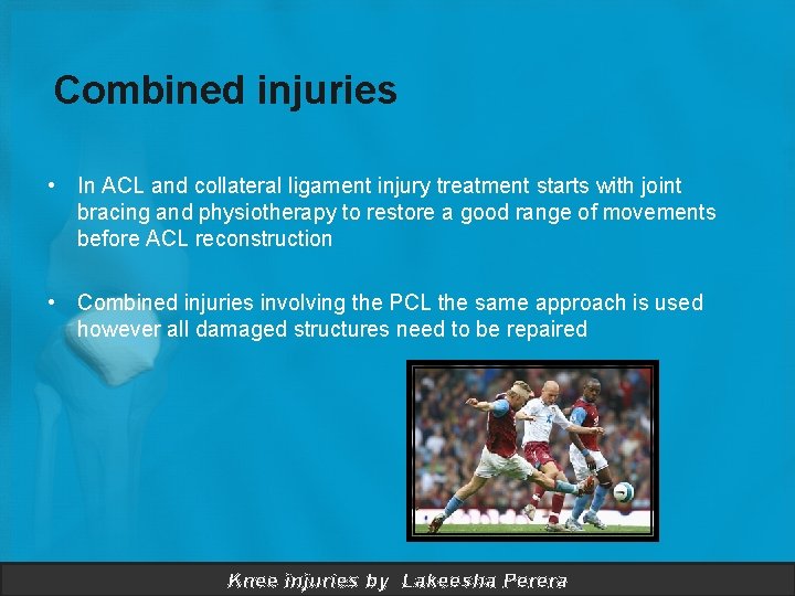 Combined injuries • In ACL and collateral ligament injury treatment starts with joint bracing