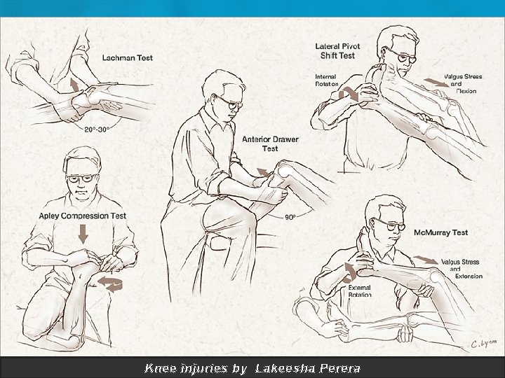 Knee injuries by Lakeesha Perera 