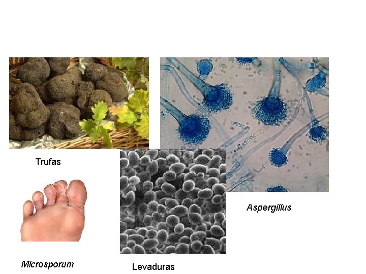 Trufas Aspergillus Microsporum Levaduras 