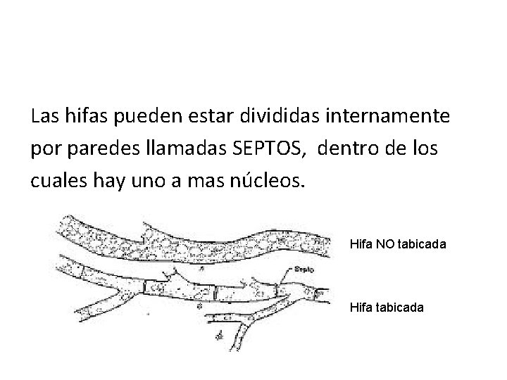 Las hifas pueden estar divididas internamente por paredes llamadas SEPTOS, dentro de los cuales