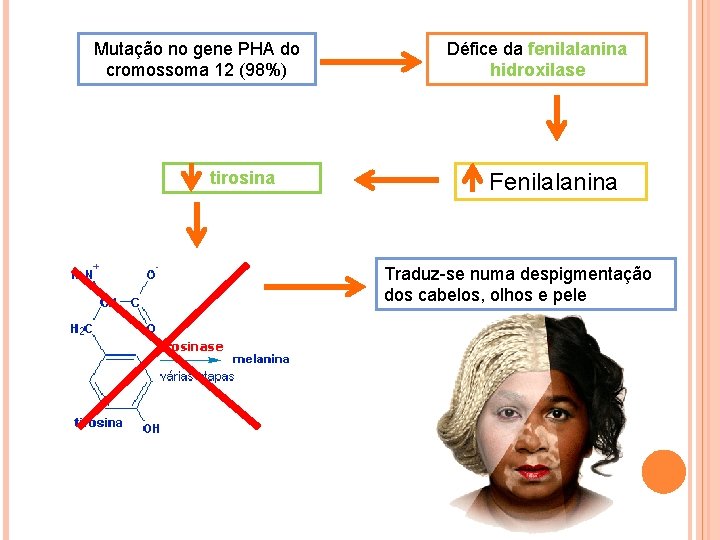 Mutação no gene PHA do cromossoma 12 (98%) tirosina Défice da fenilalanina hidroxilase Fenilalanina