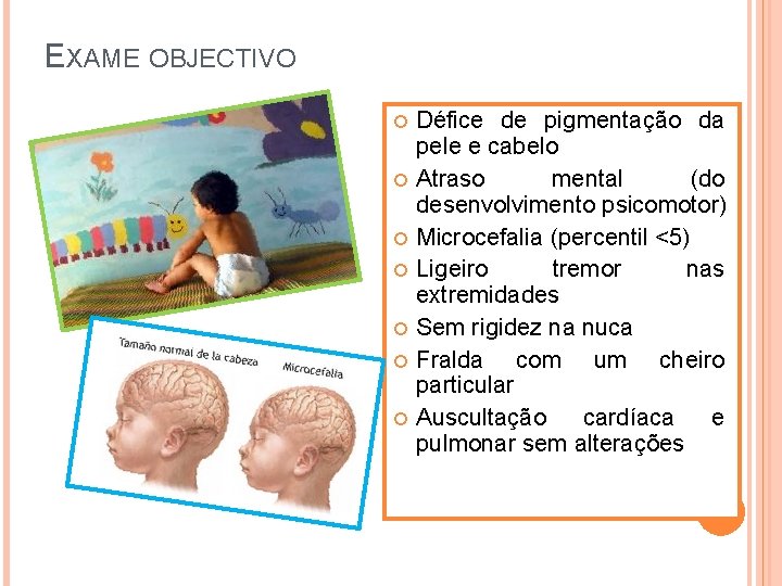 EXAME OBJECTIVO Défice de pigmentação da pele e cabelo Atraso mental (do desenvolvimento psicomotor)