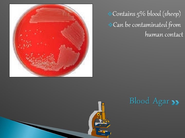 v. Contains 5% blood (sheep) v. Can be contaminated from human contact Blood Agar