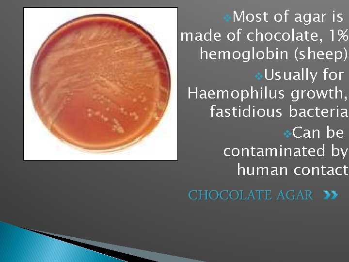 v. Most of agar is made of chocolate, 1% hemoglobin (sheep) v. Usually for