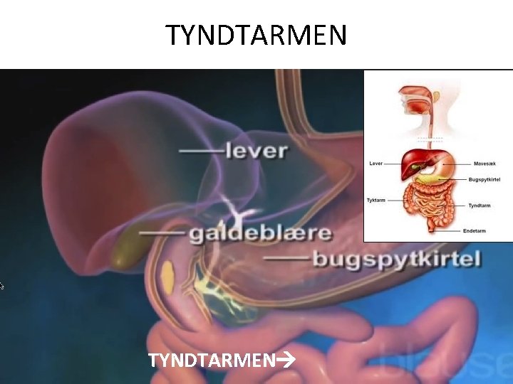 TYNDTARMEN 