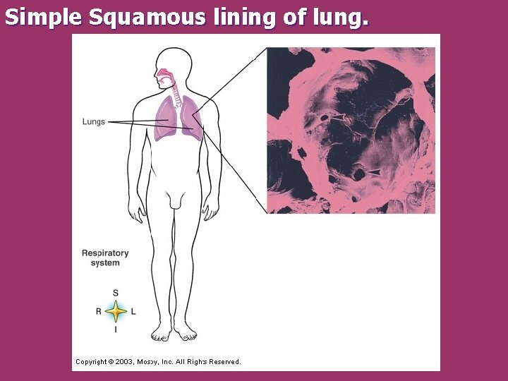 Simple Squamous lining of lung. 