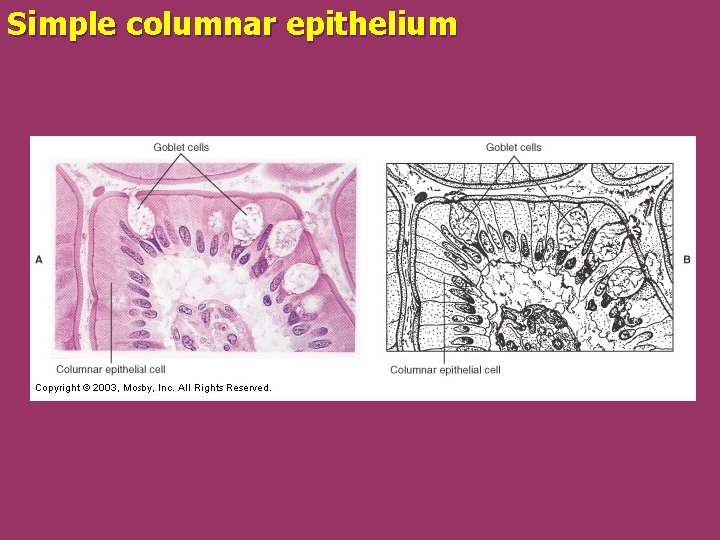 Simple columnar epithelium 