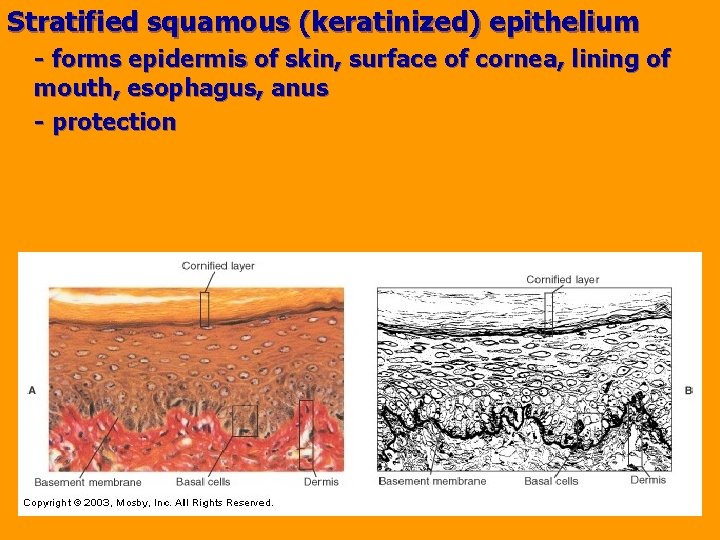 Stratified squamous (keratinized) epithelium - forms epidermis of skin, surface of cornea, lining of