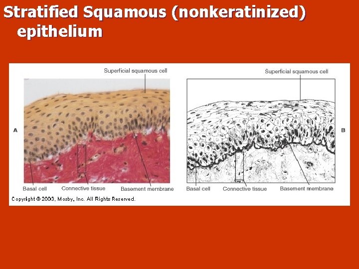 Stratified Squamous (nonkeratinized) epithelium 