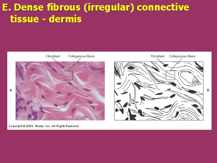 E. Dense fibrous (irregular) connective tissue - dermis 