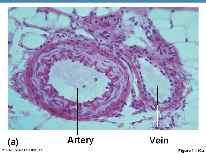 (a) © 2012 Pearson Education, Inc. Artery Vein Figure 11. 10 a (a) © 2012 Pearson Education, Inc. Artery Vein Figure 11. 10 a