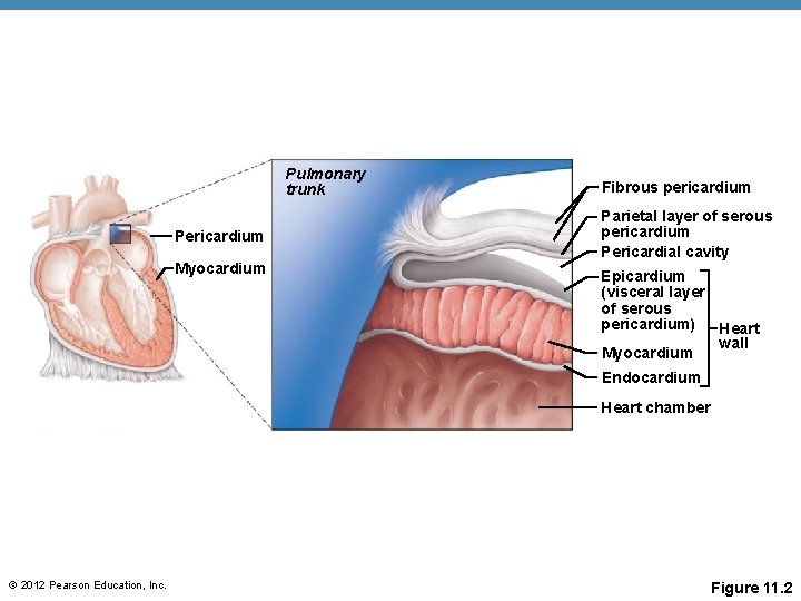 Pulmonary trunk Pericardium Myocardium Fibrous pericardium Parietal layer of serous pericardium Pericardial cavity Epicardium Pulmonary trunk Pericardium Myocardium Fibrous pericardium Parietal layer of serous pericardium Pericardial cavity Epicardium