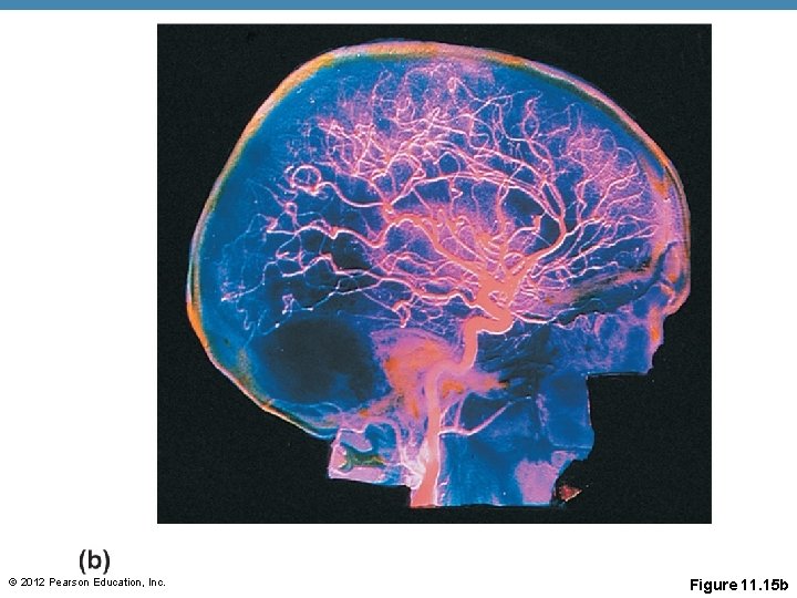 © 2012 Pearson Education, Inc. Figure 11. 15 b © 2012 Pearson Education, Inc. Figure 11. 15 b