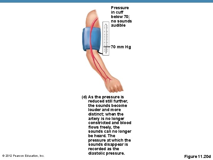 Pressure in cuff below 70; no sounds audible 70 mm Hg © 2012 Pearson Pressure in cuff below 70; no sounds audible 70 mm Hg © 2012 Pearson