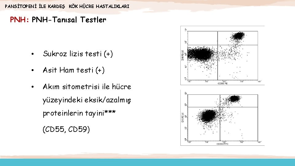 PANSİTOPENİ İLE KARDEŞ KÖK HÜCRE HASTALIKLARI PNH: PNH-Tanısal Testler • Sukroz lizis testi (+)