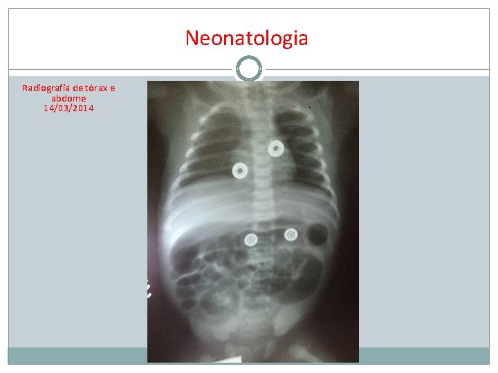Neonatologia Radiografia de tórax e abdome 14/03/2014 