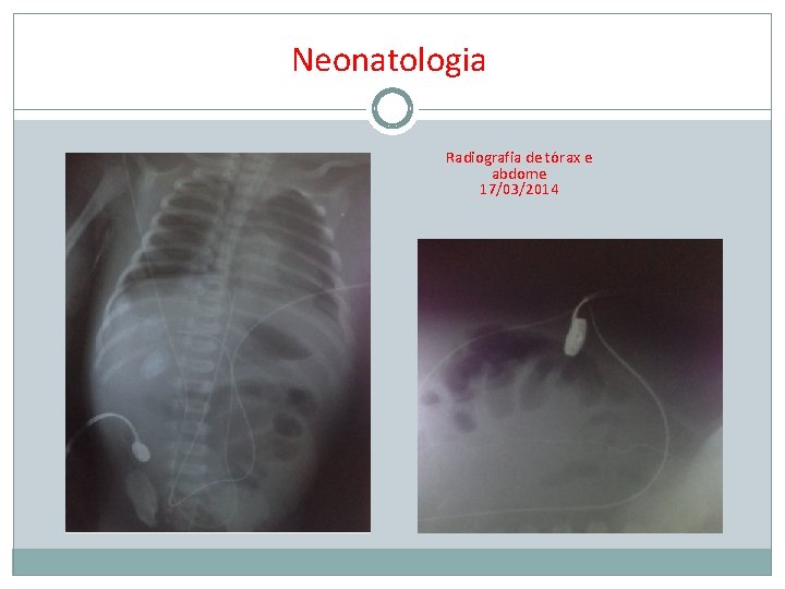 Neonatologia Radiografia de tórax e abdome 17/03/2014 