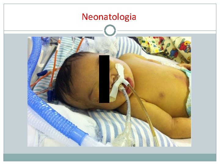 Neonatologia 