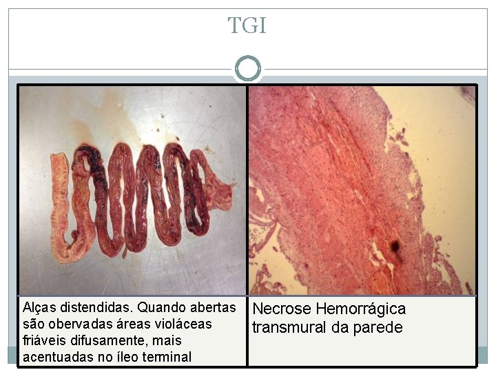 TGI Alças distendidas. Quando abertas são obervadas áreas violáceas friáveis difusamente, mais acentuadas no