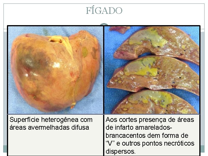 FÍGADO Superfície heterogênea com áreas avermelhadas difusa Aos cortes presença de áreas de infarto