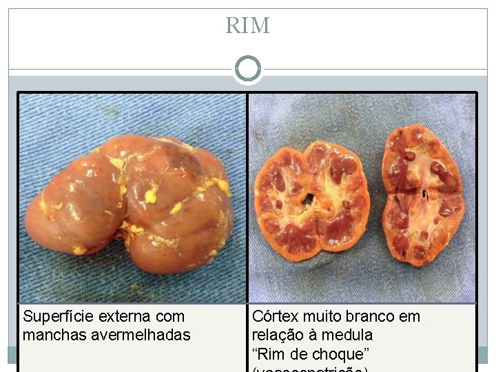 RIM Superfície externa com manchas avermelhadas Córtex muito branco em relação à medula “Rim