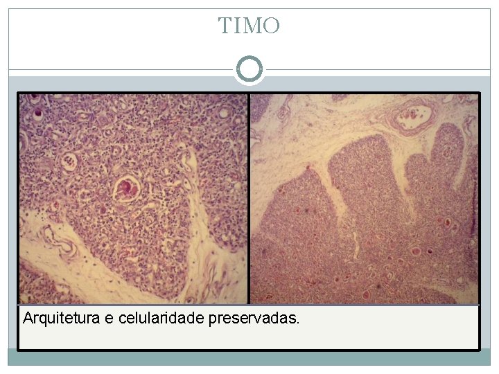 TIMO Arquitetura e celularidade preservadas. 