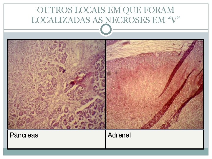 OUTROS LOCAIS EM QUE FORAM LOCALIZADAS AS NECROSES EM “V” Pâncreas Adrenal 