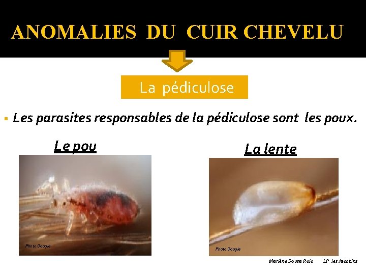 ANOMALIES DU CUIR CHEVELU �La § pédiculose Les parasites responsables de la pédiculose sont