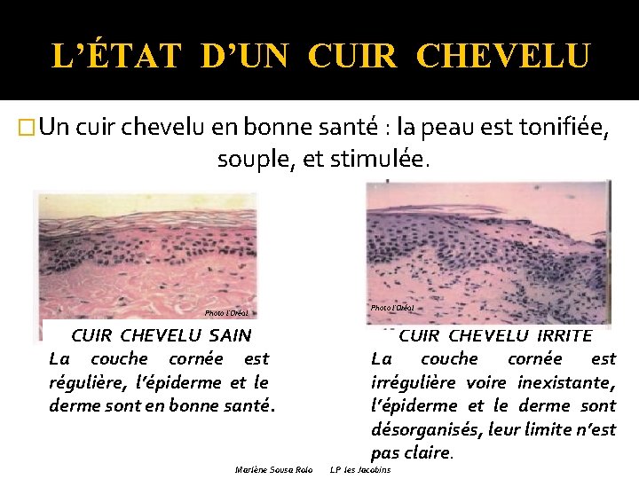 L’ÉTAT D’UN CUIR CHEVELU �Un cuir chevelu en bonne santé : la peau est