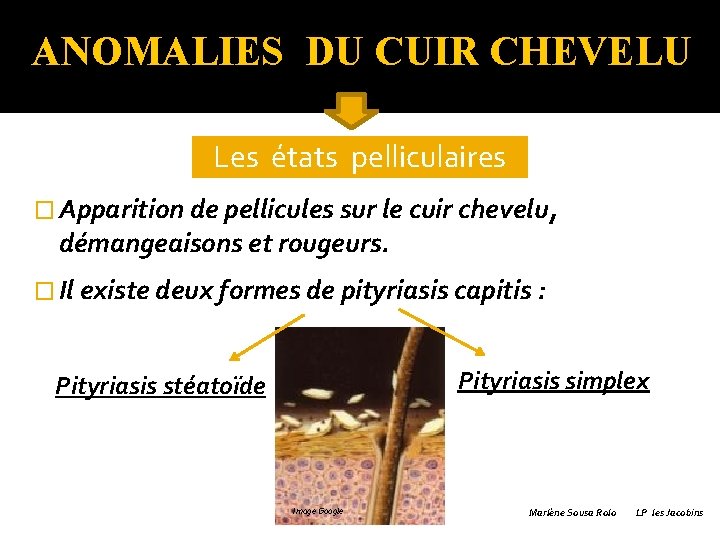 ANOMALIES DU CUIR CHEVELU Les états pelliculaires � Apparition de pellicules sur le cuir