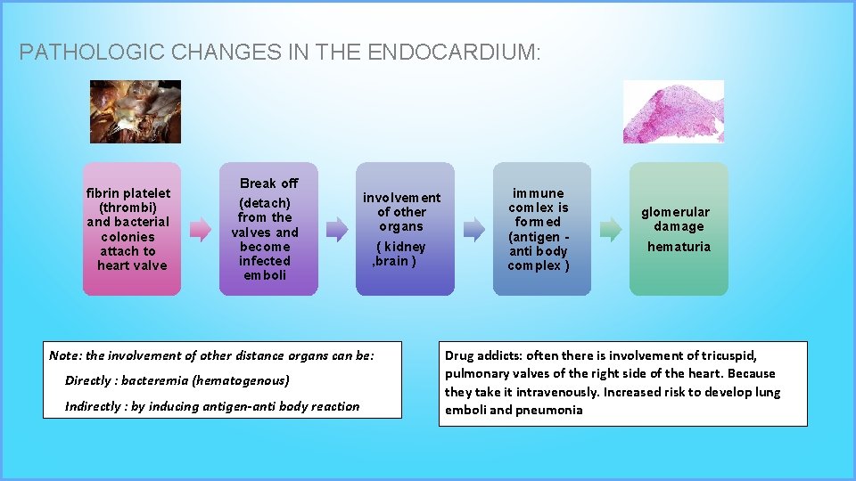 PATHOLOGIC CHANGES IN THE ENDOCARDIUM: fibrin platelet (thrombi) and bacterial colonies attach to heart