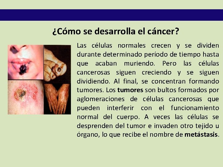 ¿Cómo se desarrolla el cáncer? Las células normales crecen y se dividen durante determinado