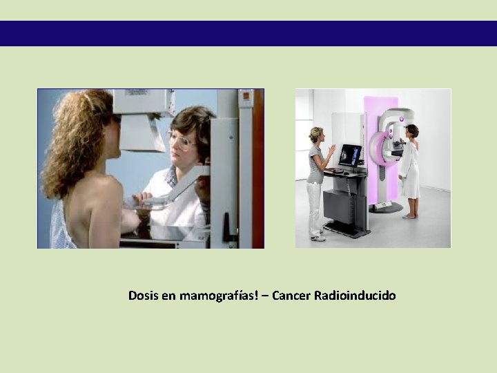 Dosis en mamografías! – Cancer Radioinducido 