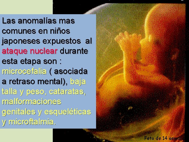 Las anomalías mas comunes en niños japoneses expuestos al ataque nuclear durante esta etapa