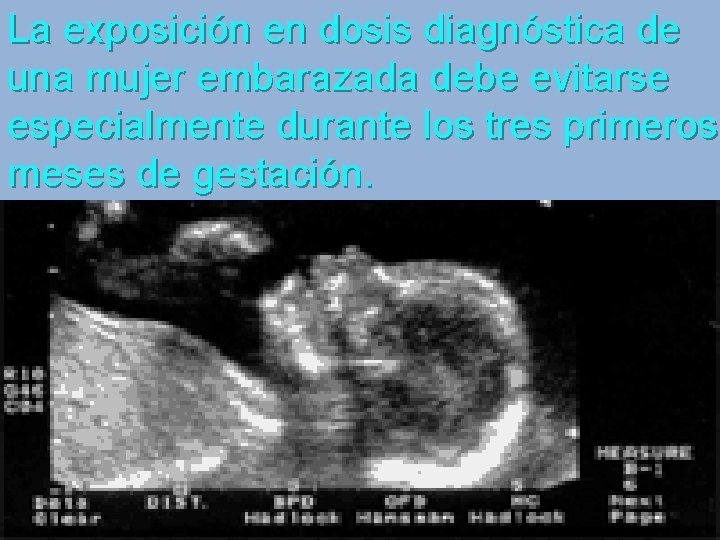 La exposición en dosis diagnóstica de una mujer embarazada debe evitarse especialmente durante los