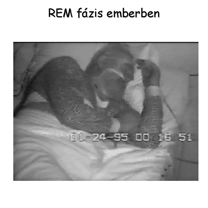 REM fázis emberben 