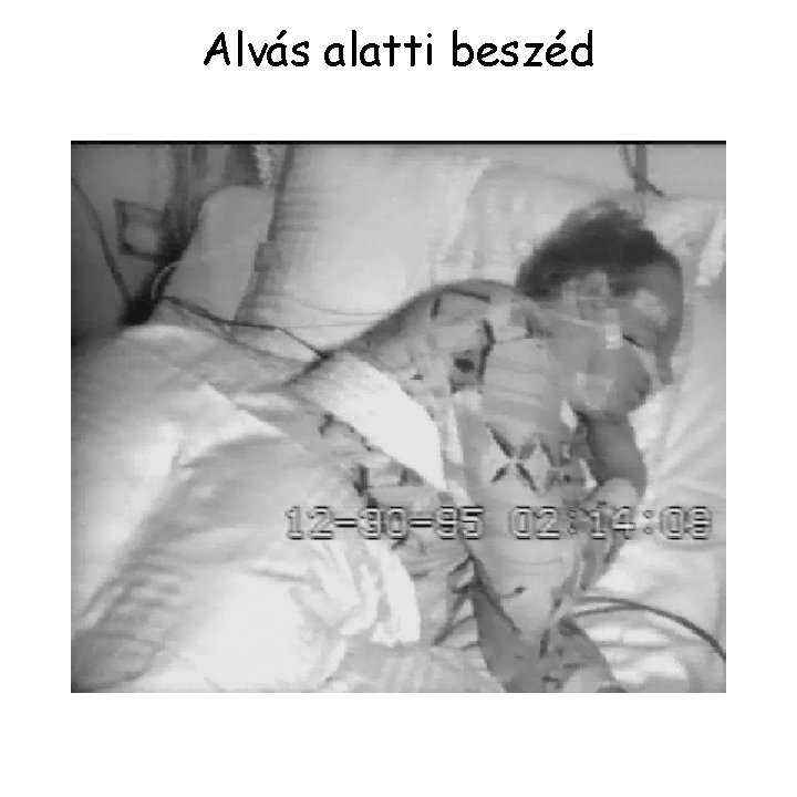 Alvás alatti beszéd 