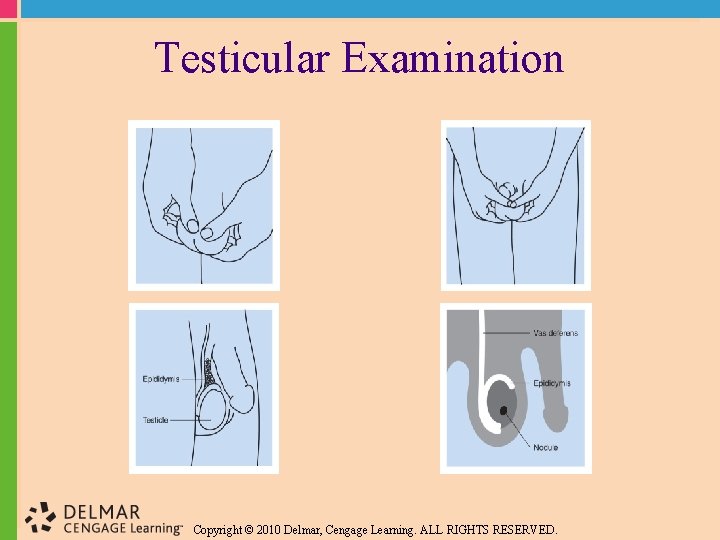 Testicular Examination Copyright © 2010 Delmar, Cengage Learning. ALL RIGHTS RESERVED. 