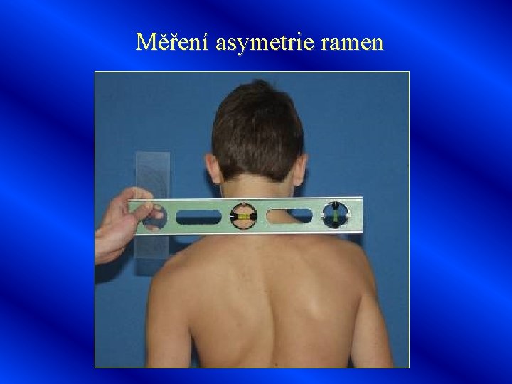 Měření asymetrie ramen 