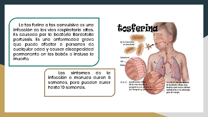 La tos ferina o tos convulsiva es una infección de las vías respiratoria altas.