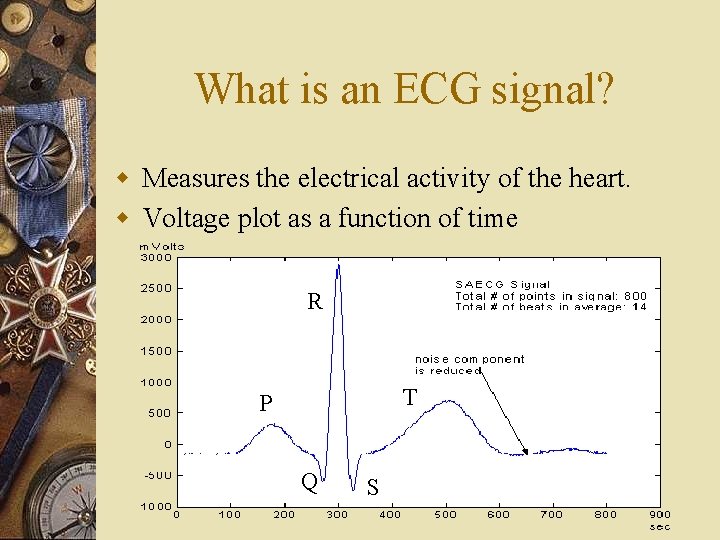 What is an ECG signal? w Measures the electrical activity of the heart. w What is an ECG signal? w Measures the electrical activity of the heart. w