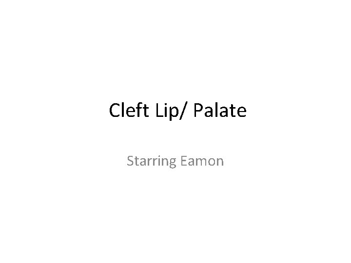Cleft Lip/ Palate Starring Eamon 
