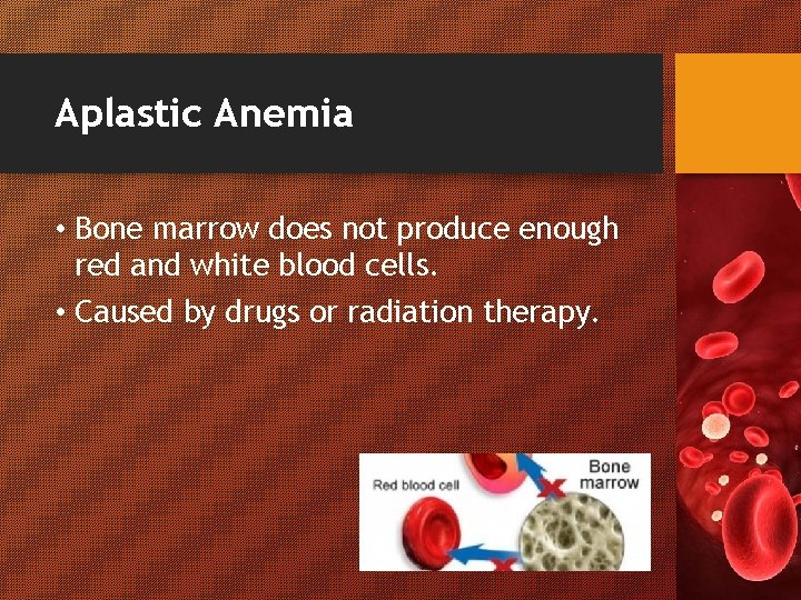 Aplastic Anemia • Bone marrow does not produce enough red and white blood cells.